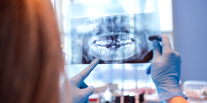 Dentist pointing at dental xray