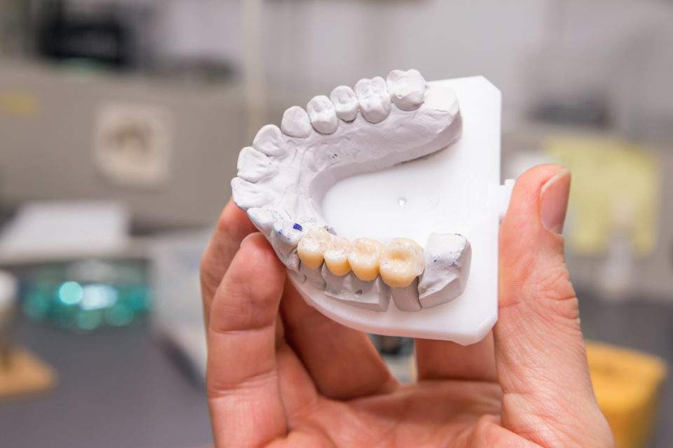 Model of teeth in hand