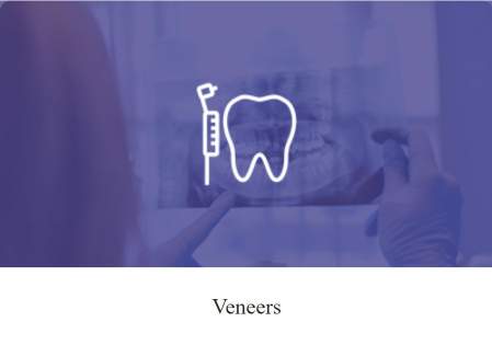 Veneers